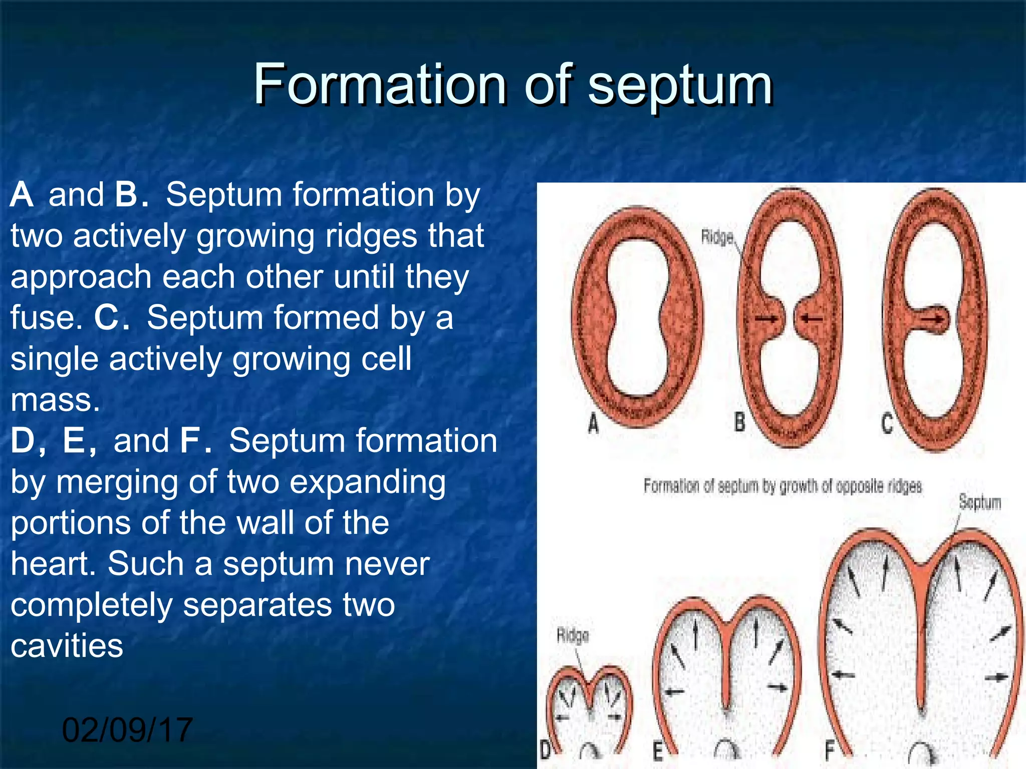 02/09/17
Formation of septumFormation of septum
A and B. Septum formation by
two actively growing ridges that
approach each other until they
fuse. C. Septum formed by a
single actively growing cell
mass.
D, E, and F. Septum formation
by merging of two expanding
portions of the wall of the
heart. Such a septum never
completely separates two
cavities
 