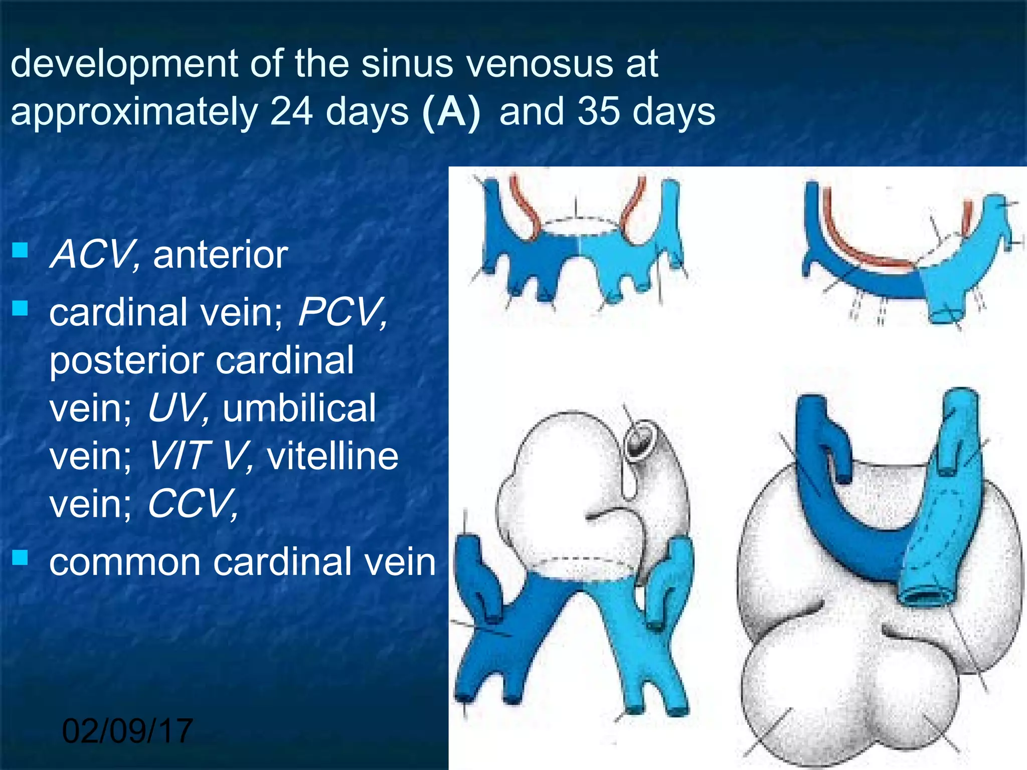 02/09/17
development of the sinus venosus at
approximately 24 days (A) and 35 days
 ACV, anterior
 cardinal vein; PCV,
posterior cardinal
vein; UV, umbilical
vein; VIT V, vitelline
vein; CCV,
 common cardinal vein
 