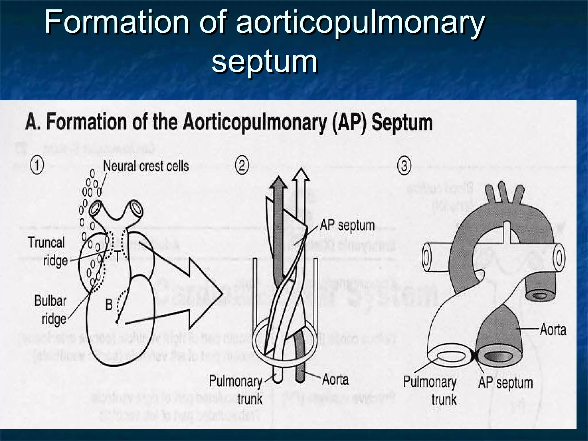 02/09/17
Formation of aorticopulmonaryFormation of aorticopulmonary
septumseptum
 