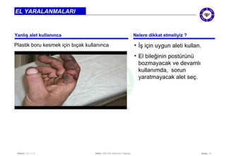 Seite: 12 
EL YARALANMALARI 
Yanlış alet kullanınca Nelere dikkat etmeliyiz ? 
Datum: 22/11/14 Datei: 550 DIA Diamond Training 
• İş için uygun aleti kullan. 
• El bileğinin postürünü 
bozmayacak ve devamlı 
kullanımda, sorun 
yaratmayacak alet seç. 
Plastik boru kesmek için bıçak kullanınca 
 