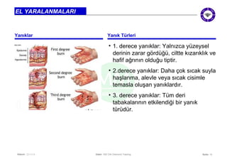 • 1. derece yanıklar: Yalnızca yüzeysel 
derinin zarar gördüğü, ciltte kızarıklık ve 
hafif ağrının olduğu tiptir. 
• 2.derece yanıklar: Daha çok sıcak suyla 
haşlanma, alevle veya sıcak cisimle 
temasla oluşan yanıklardır. 
• 3. derece yanıklar: Tüm deri 
tabakalarının etkilendiği bir yanık 
türüdür. 
Seite: 14 
EL YARALANMALARI 
Yanıklar Yanık Türleri 
Datum: 22/11/14 Datei: 550 DIA Diamond Training 
 