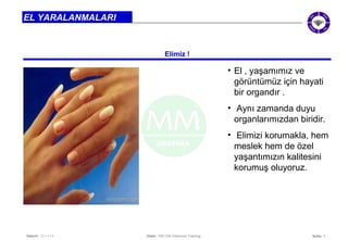 Seite: 3 
EL YARALANMALARI 
Elimiz ! 
Datum: 22/11/14 Datei: 550 DIA Diamond Training 
• El , yaşamımız ve 
görüntümüz için hayati 
bir organdır . 
• Aynı zamanda duyu 
organlarımızdan biridir. 
• Elimizi korumakla, hem 
meslek hem de özel 
yaşantımızın kalitesini 
korumuş oluyoruz. 
 