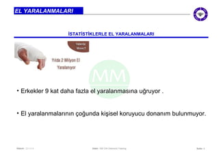 • El yaralanmalarının çoğunda kişisel koruyucu donanım bulunmuyor. 
Seite: 4 
EL YARALANMALARI 
İSTATİSTİKLERLE EL YARALANMALARI 
• Erkekler 9 kat daha fazla el yaralanmasına uğruyor . 
Datum: 22/11/14 Datei: 550 DIA Diamond Training 
 