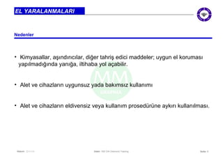 • Kimyasallar, aşındırıcılar, diğer tahriş edici maddeler; uygun el koruması 
yapılmadığında yanığa, iltihaba yol açabilir. 
• Alet ve cihazların eldivensiz veya kullanım prosedürüne aykırı kullanılması. 
Seite: 8 
EL YARALANMALARI 
Nedenler 
• Alet ve cihazların uygunsuz yada bakımsız kullanımı 
Datum: 22/11/14 Datei: 550 DIA Diamond Training 
 