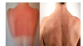 mecanismos de prevencion