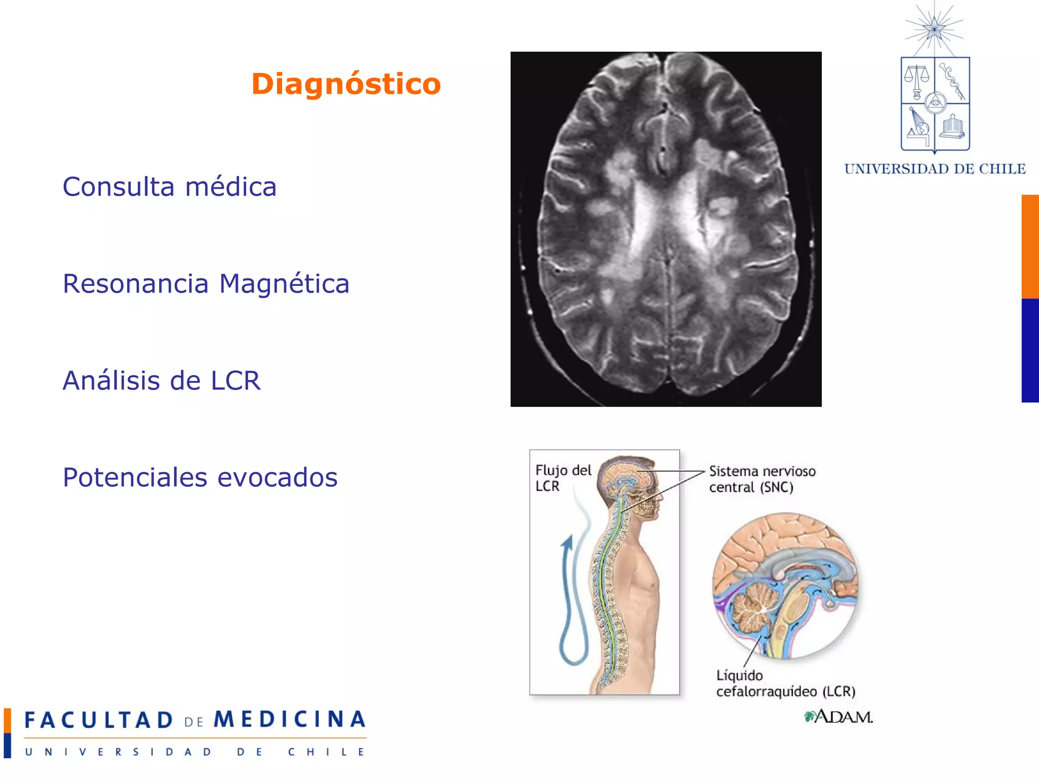 Diagnóstico Consulta médica Resonancia Magnética Análisis de LCR Potenciales evocados 