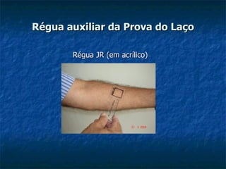 Régua auxiliar da Prova do Laço Régua JR (em acrílico) 