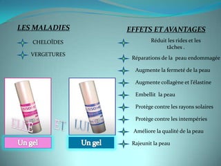 LES MALADIES    EFFETS ET AVANTAGES
   CHELOÏDES            Réduit les rides et les
                              tâches .
   VERGETURES
                 Réparations de la peau endommagée

                  Augmente la fermeté de la peau

                  Augmente collagène et l’élastine

                  Embellit la peau

                  Protège contre les rayons solaires

                  Protège contre les intempéries

                 Améliore la qualité de la peau

                 Rajeunit la peau
 