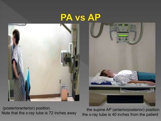 Ap Position Radiology chest radiology in ICU | PPTX