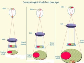 Schimbarea dimensiunii imaginii
virtuale odată cu schimbarea
distanţei dintre lupă şi obiect
La schimbarea distanţei lupei faţă de obiect se
poate observa cum imaginea virtuală îşi schimbă la
rândui ei dimensiunile. După cum puteţi vedea în
imaginea de mai jos, odată cu depărtarea lupei de
obiect, acesta pare mai mare; este ca şi cum
obiectul ar fi mai aproape de dumneavoastră, ca şi
cum o fotografie a obiectului se apropie sau de
depărtează de ochi.
În realitatea, există o limită a depărtării lupei de
obiect şi, prin urmare, a capacităţii lupei de a mări
obiectul. Dacă îndepărtaţi prea mult lupa de
obiectul observat, imaginea va deveni neclară şi nu
veţi mai putea vedea nimic.
 