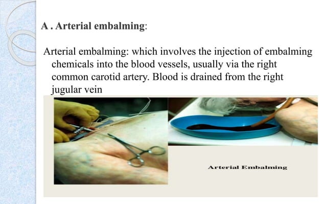 EMBALMING 12.11.22.pptx