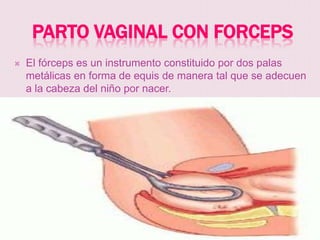 PARTO VAGINAL CON FORCEPS
   El fórceps es un instrumento constituido por dos palas
    metálicas en forma de equis de manera tal que se adecuen
    a la cabeza del niño por nacer.
 