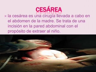 CESÁREA
   la cesárea es una cirugía llevada a cabo en
    el abdomen de la madre. Se trata de una
    incisión en la pared abdominal con el
    propósito de extraer al niño.
 