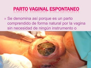 PARTO VAGINAL ESPONTANEO
   Se denomina así porque es un parto
    comprendido de forma natural por la vagina
    sin necesidad de ningún instrumento o
    tecnología.
 