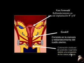 Von Fernwald
Reblandecimiento en
zona de implantación 4° y 5°

Goodell
Consiste en la cianosis
y reblandecimiento del
cuello uterino.
Coloración violácea
de paredes vaginales
debido a la congestión
de los vasos pélvicos.

 