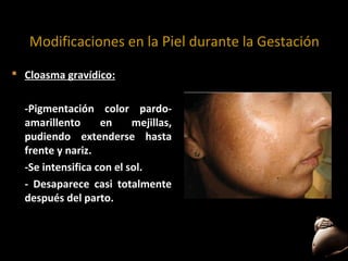 Modificaciones en la Piel durante la Gestación
 Cloasma gravídico:
-Pigmentación color pardoamarillento
en
mejillas,
pudiendo extenderse hasta
frente y nariz.
-Se intensifica con el sol.
- Desaparece casi totalmente
después del parto.

 