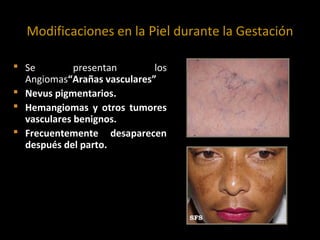Modificaciones en la Piel durante la Gestación
 Se
presentan
los
Angiomas“Arañas vasculares”
 Nevus pigmentarios.
 Hemangiomas y otros tumores
vasculares benignos.
 Frecuentemente desaparecen
después del parto.

 
