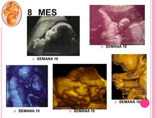 8 MES





SEMANA 10

SEMANA 10




SEMANA 10



SEMANA 10

SEMANA 10

 