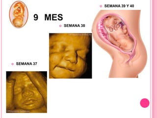 
9 MES
SEMANA 37
SEMANA 38
SEMANA 39 Y 40