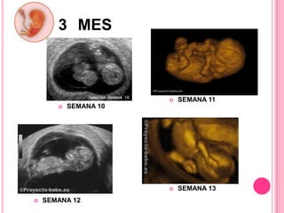 3 MES
SEMANA 11
SEMANA 13
SEMANA 10
SEMANA 12