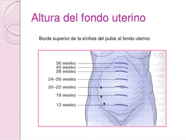 Medicion De Fondo Uterino Slingo Medicion De Fondo Uterino Slingo