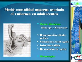 MMoorrbbii--mmoorrttaalliiddaadd mmaatteerrnnaa aassoocciiaaddaa 
aall eemmbbaarraazzoo eenn aaddoolleesscceenntteess 
 PPaarrttooss ddiissttóócciiccooss 
((FFóórrcceeppss yy CCeessáárreeaass)):: 
◆ DDeesspprrooppoorrcciióónn ccééffaalloo-- 
ppééllvviiccaa 
◆ SSuuffrriimmiieennttoo ffeettaall aagguuddoo 
◆ IInndduucccciióónn ffaalllliiddaa 
◆ PPrreesseennttaacciióónn ddee ppeellvviiss 
 HHeemmoorrrraaggiiaass 
 