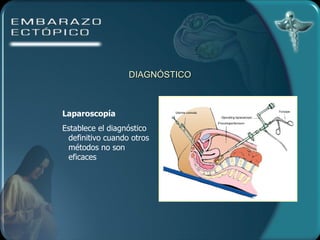 DIAGNÓSTICO Laparoscopía Establece el diagnóstico definitivo cuando otros métodos no son eficaces 