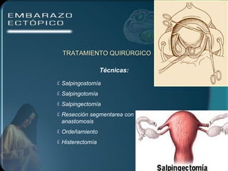 TRATAMIENTO QUIRÚRGICO Técnicas: Salpingostomía Salpingotomía Salpingectomía Resección segmentarea con anastomosis Ordeñamiento Histerectomía 