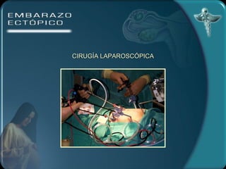 CIRUGÍA LAPAROSCÓPICA 
