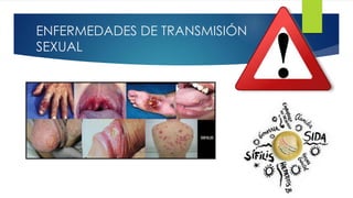 ENFERMEDADES DE TRANSMISIÓN
SEXUAL