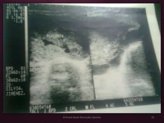 Dr.Frank Xavier Bermudez Sanchez   23
 
