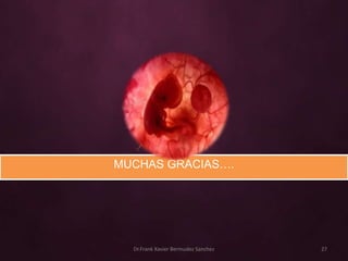 MUCHAS GRACIAS….




  Dr.Frank Xavier Bermudez Sanchez   27
 