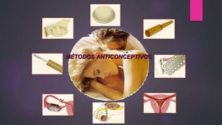 MÉTODOS ANTICONCEPTIVOS
 