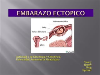 Actividad 2 de Gincologia y Obstetricia  Universidad Autonoma de Guadalajara Yancy Jimmy Greg Spencer 