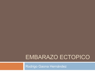 EMBARAZO ECTOPICO
Rodrigo Gaona Hernández
 