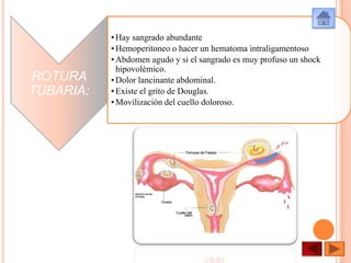 ROTURA
TUBARIA:

• Hay sangrado abundante
• Hemoperitoneo o hacer un hematoma intraligamentoso
• Abdomen agudo y si el sangrado es muy profuso un shock
hipovolémico.
• Dolor lancinante abdominal.
• Existe el grito de Douglas.
• Movilización del cuello doloroso.

 