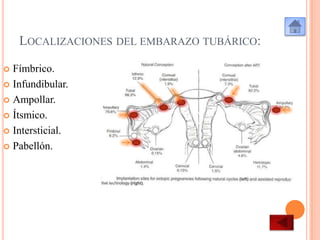 LOCALIZACIONES DEL EMBARAZO TUBÁRICO:
Fímbrico.
 Infundibular.
 Ampollar.
 Ítsmico.
 Intersticial.
 Pabellón.


 