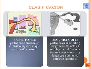 PRIMITIVO: La
gestación se produce en
el mismo lugar en el que
se fecundó el óvulo.

SECUNDARIO: La
gestación es en un sitio y
luego se reimplanta en
otro lugar ej: el óvulo es
fecundado en el ovario y
luego cae a peritoneo
donde se desarrolla.

 