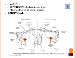 

OVARICO:
◦

SUPERFICIAL: En la corteza ovárica.
◦ PROFUNDO: En un folículo ovárico


ABDOMINAL

 