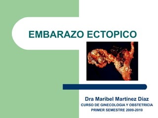 EMBARAZO ECTOPICO 
Dra Maribel Martínez Díaz 
CURSO DE GINECOLOGIA Y OBSTETRICIA 
PRIMER SEMESTRE 2009-2010 
 