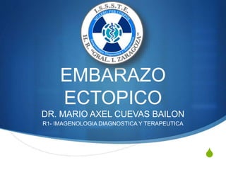 S
EMBARAZO
ECTOPICO
DR. MARIO AXEL CUEVAS BAILON
R1- IMAGENOLOGIA DIAGNOSTICA Y TERAPEUTICA
 