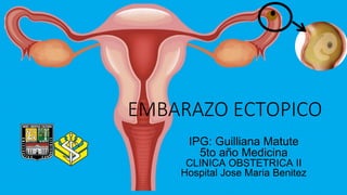EMBARAZO ECTOPICO
IPG: Guilliana Matute
5to año Medicina
CLINICA OBSTETRICA II
Hospital Jose Maria Benitez
 