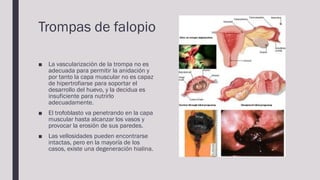 Trompas de falopio
■ La vascularización de la trompa no es
adecuada para permitir la anidación y
por tanto la capa muscula...