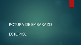 ROTURA DE EMBARAZO
ECTOPICO
 