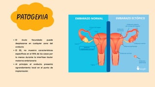 PATOGENIA
El óvulo fecundado puede
desplazarse en cualquier zona del
oviducto
El EE, no muestra características
específicas en el 95% de los casos por
lo menos durante la interfase tisular
materna embrionaria
Al principio el oviducto presenta
agrandamiento local en el punto de
implantación
 