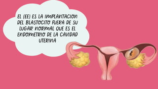 EL (EE) ES LA IMPLANTACION
DEL BLASTOCITO FUERA DE SU
LUGAR NORMAL QUE ES EL
ENDOMETRIO DE LA CAVIDAD
UTERINA
 
