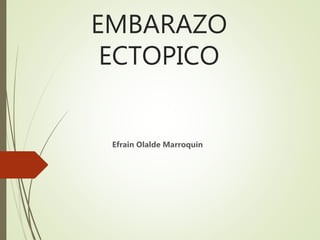 EMBARAZO
ECTOPICO
Efrain Olalde Marroquín
 