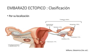 EMBARAZO ECTOPICO : Clasificación
• Por su localización
Williams. Obstetricia (24a. ed.)
 