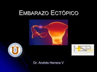 EMBARAZO ECTÓPICO
Dr. Andrés Herrera V
 