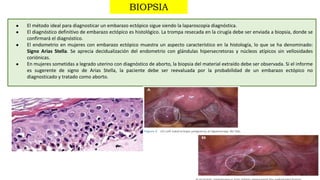 1
5
● El método ideal para diagnosticar un embarazo ectópico sigue siendo la laparoscopia diagnóstica.
● El diagnóstico definitivo de embarazo ectópico es histológico. La trompa resecada en la cirugía debe ser enviada a biopsia, donde se
confirmará el diagnóstico.
● El endometrio en mujeres con embarazo ectópico muestra un aspecto característico en la histología, lo que se ha denominado:
Signo Arias Stella. Se aprecia decidualización del endometrio con glándulas hipersecretoras y núcleos atípicos sin vellosidades
coriónicas.
● En mujeres sometidas a legrado uterino con diagnóstico de aborto, la biopsia del material extraído debe ser observada. Si el informe
es sugerente de signo de Arias Stella, la paciente debe ser reevaluada por la probabilidad de un embarazo ectópico no
diagnosticado y tratado como aborto.
BIOPSIA
 